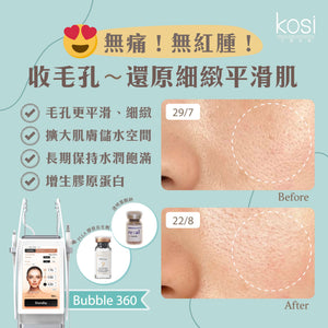 Bubble 360 無痛收毛孔及凹凸洞療程