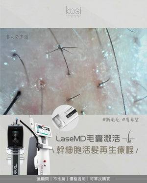 LaseMD表皮重生 -  幹細胞活髮再生療程(局部/半頭)