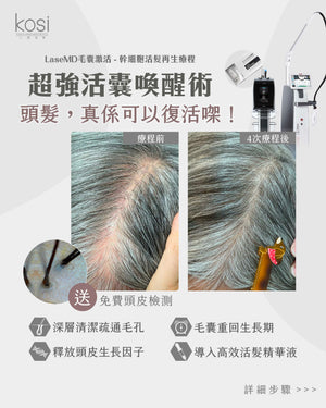 LaseMD表皮重生 -  幹細胞活髮再生療程(局部/半頭)