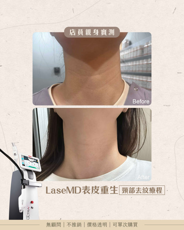 LaseMD表皮重生 - 頸部去紋收緊療程(頸)