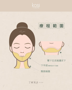 Alma PrimeX 超頻緊膚儀 - weewee聲超聲波雙下巴溶脂療程