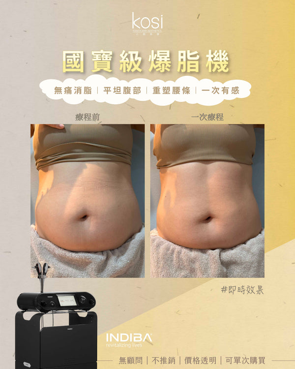 Indiba 國寶級溶脂收緊儀 - 內外夾擊減脂療程