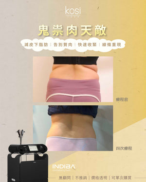 Indiba 國寶級溶脂收緊儀 - 內外夾擊減脂療程