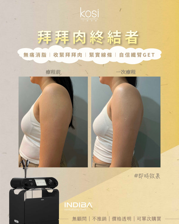 Indiba 國寶級溶脂收緊儀 - 內外夾擊減脂療程