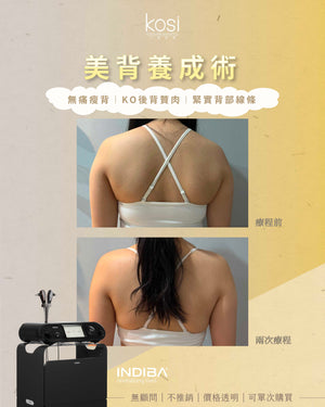 Indiba 國寶級溶脂收緊儀 - 內外夾擊減脂療程