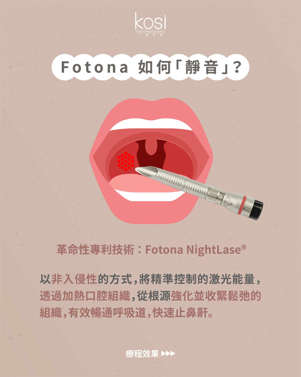 Fotona NightLase 無創去鼻鼾療程