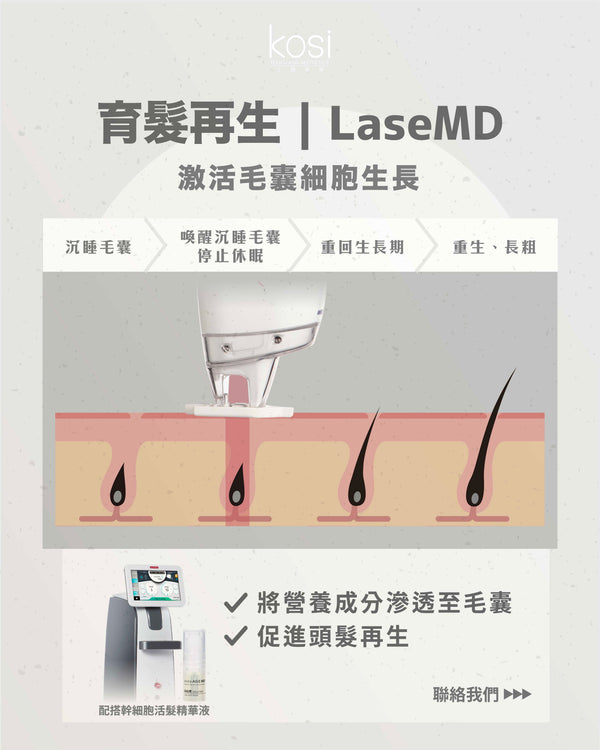 LaseMD表皮重生 -  幹細胞活髮再生療程(局部/半頭)