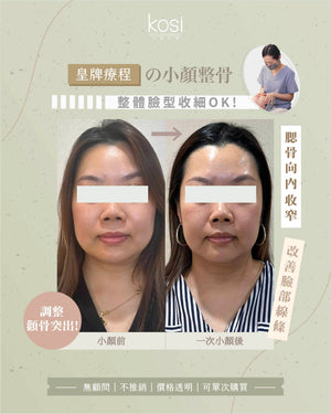 Kosi皇牌小顏整骨療程