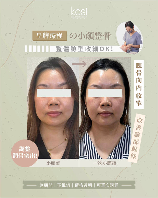 Kosi皇牌小顏整骨療程