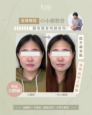 Kosi皇牌小顏整骨療程