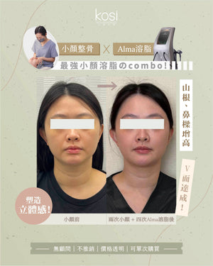 Kosi皇牌小顏整骨療程