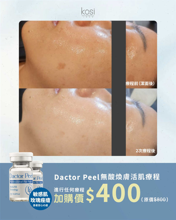 Dactor Peel 無酸煥膚活肌療程