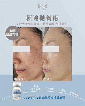 Dactor Peel 無酸煥膚活肌療程