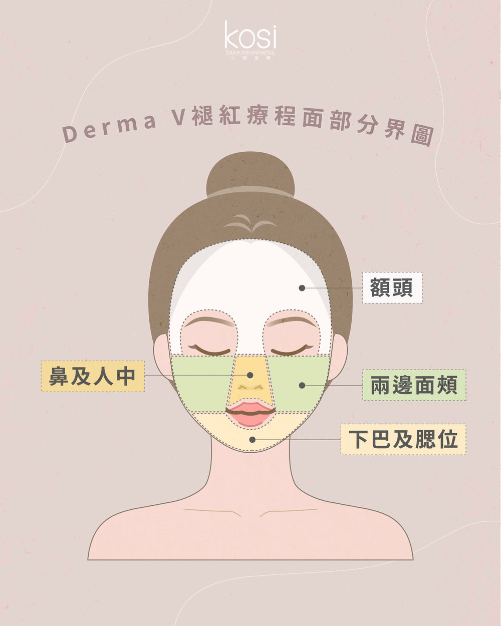 Derma V 褪紅淨白專家 - 不要面紅紅療程