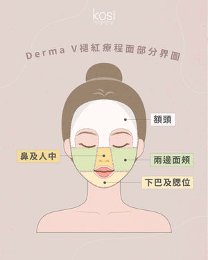Derma V 褪紅淨白專家 - 不要面紅紅療程
