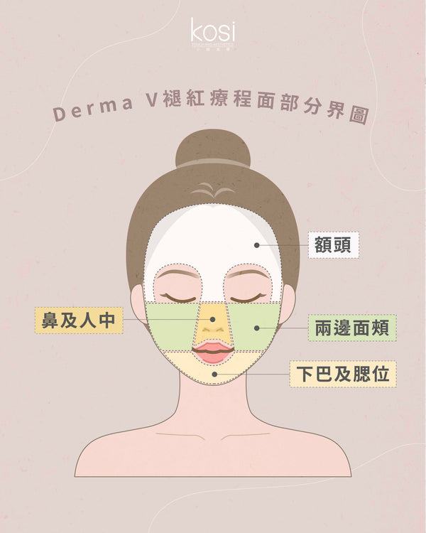 Derma V 褪紅淨白專家 - 不要面紅紅療程