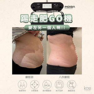 Indiba 國寶級溶脂收緊儀 - 內外夾擊減脂療程