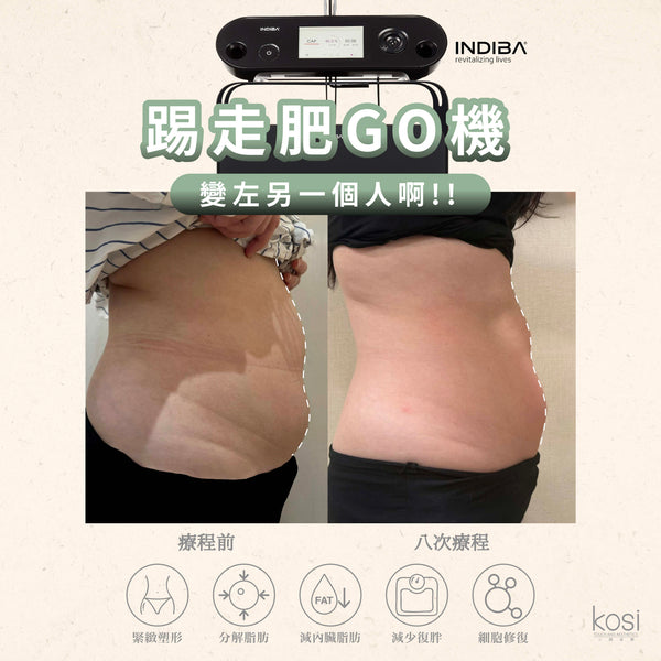 Indiba 國寶級溶脂收緊儀 - 內外夾擊減脂療程