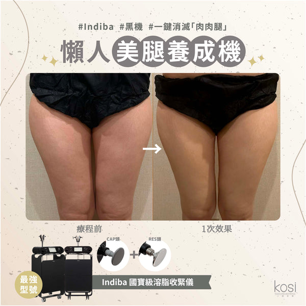 Indiba 國寶級溶脂收緊儀 - 內外夾擊減脂療程