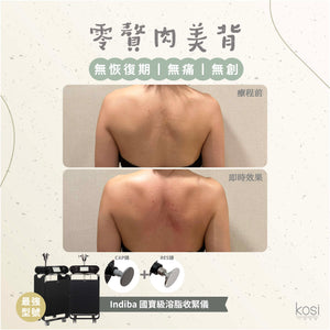Indiba 國寶級溶脂收緊儀 - 內外夾擊減脂療程