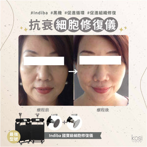 Indiba 國寶級細胞修復儀 - 內生熱抗衰老療程 (眼部)