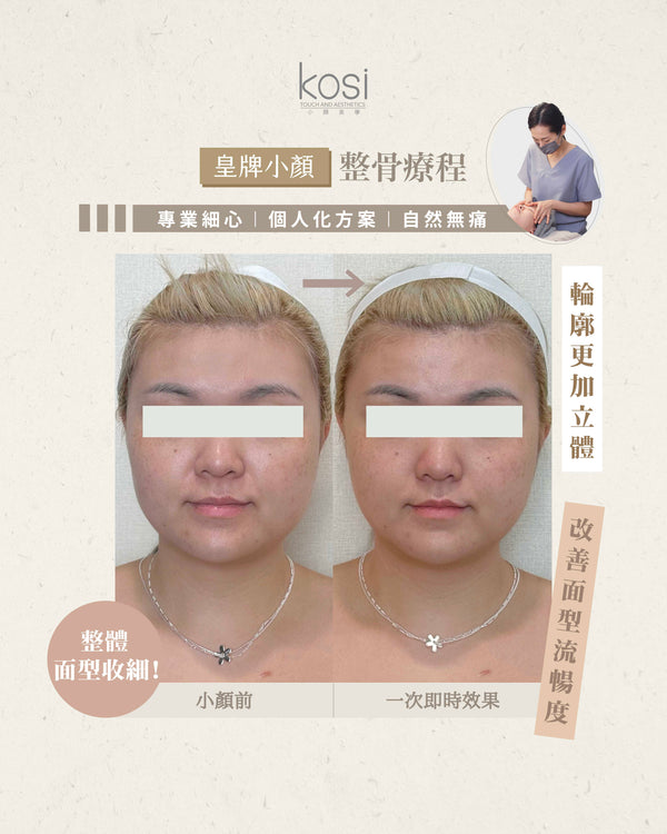 Kosi皇牌小顏整骨療程