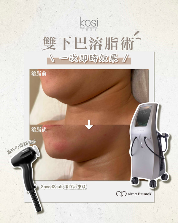 Alma PrimeX 超頻緊膚儀 - weewee聲超聲波雙下巴溶脂療程