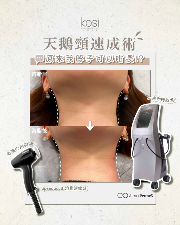 Alma PrimeX 超頻緊膚儀 - weewee聲超聲波雙下巴溶脂療程