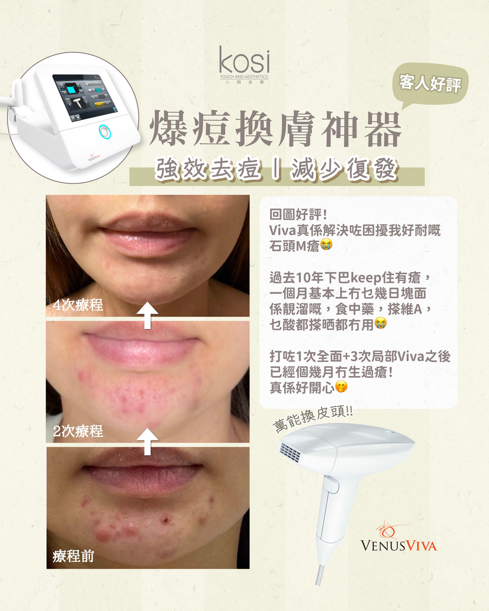 Venus Viva™ 再生換膚儀 - 淨痘/收毛孔去瑕療程(全面)