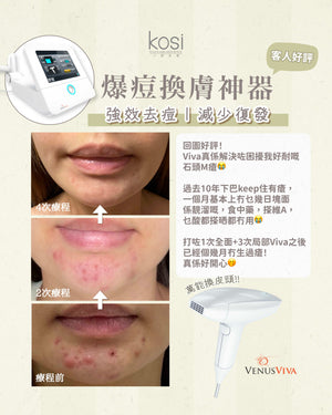 Venus Viva™ 再生換膚儀 - 強效局部去痘療程(局部)