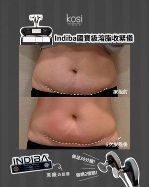 Indiba 國寶級溶脂收緊儀 - 內外夾擊減脂療程