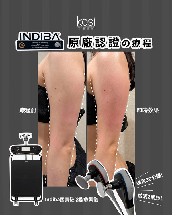 Indiba 國寶級溶脂收緊儀 - 內外夾擊減脂療程