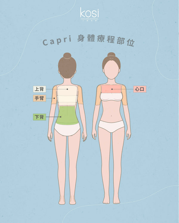 Capri 藍激光 - 減油控痘淨膚療程(身體)