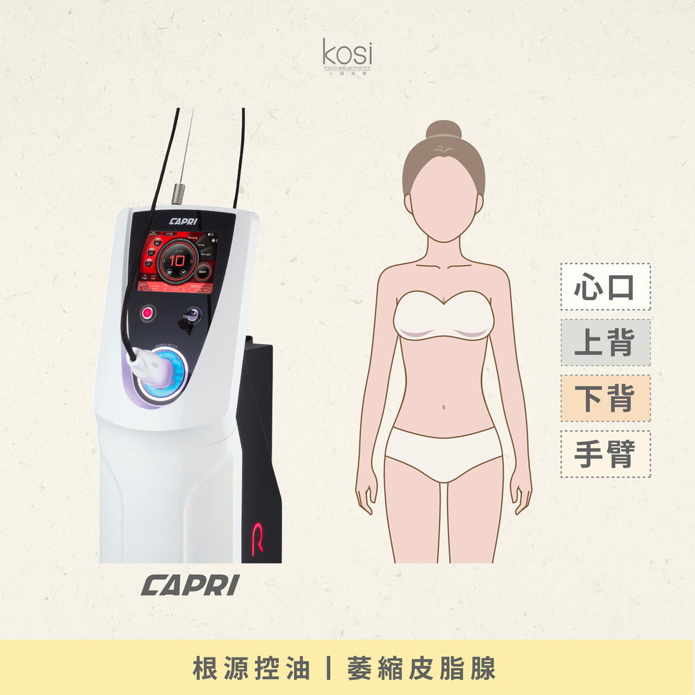 Capri 藍激光 - 減油控痘淨膚療程(身體)