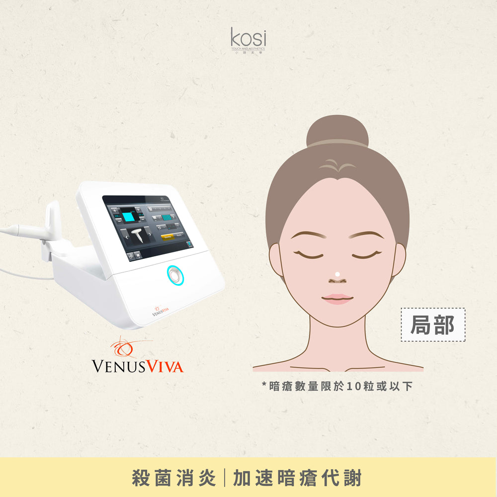 Venus Viva™ 再生換膚儀 - 強效局部去痘療程(去痘)
