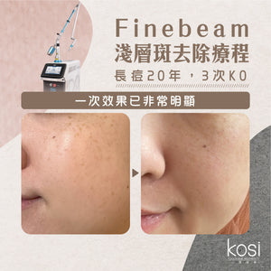 Finebeam激光 - 淺層斑去印療程